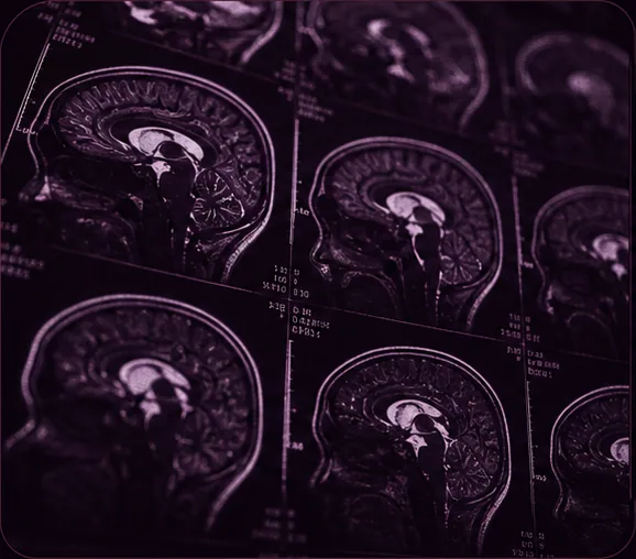 Night Glass Lab Brain Scans