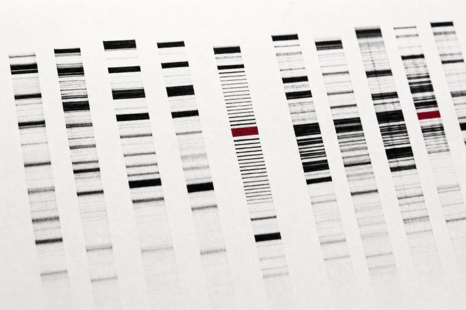Electrophoresis bands used as a laboratory result preview